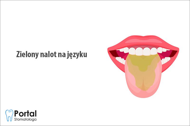 Zielony nalot na drzewach